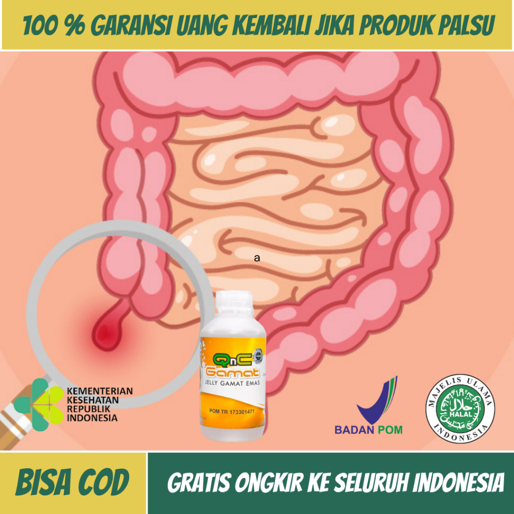 Obat Radang Usus Besar, Obat Usus Buntu, Obat Usus Buntu Akut Kronis, Obat Radang Usus Buntu, Obat U