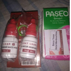Obat Luar untuk Mata ikan  | Penghilang Kutil Mata Ikan Penghancur Akar Mata Ikan |   Obat Mata Ikan
