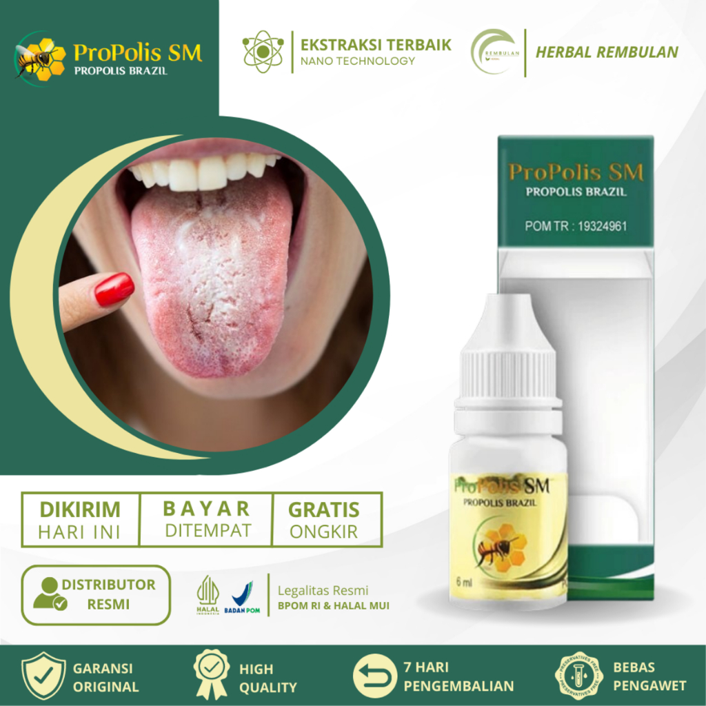 Obat Lidah Putih, Obat Lidah Putih Berjamur, Obat Kandidiasis, Obat Pembersih Lidah Putih, Lidah Put