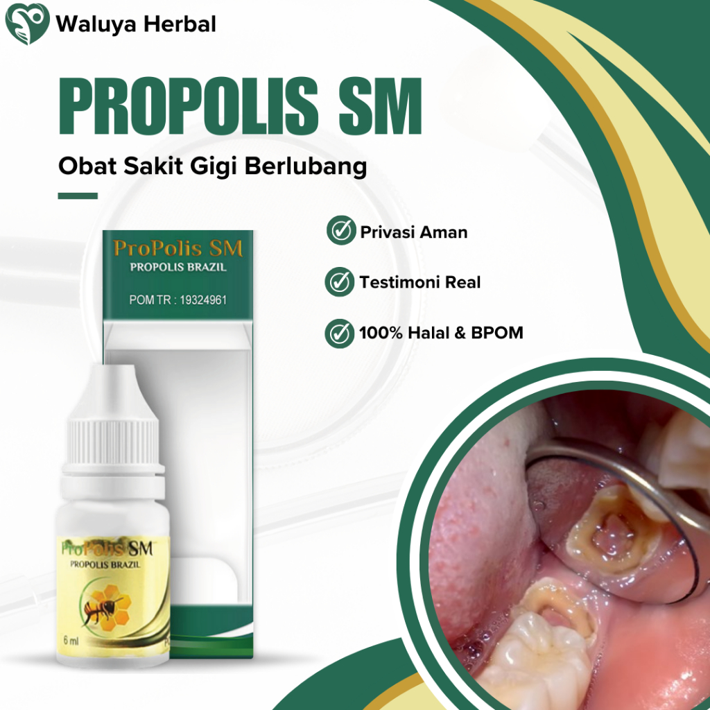 Obat Sakit Gigi Berlubang Perontok Sisa Akar Gigi Gusi Bengkak Bau Mulut Tak Sedap Akibat Gigi Berlu