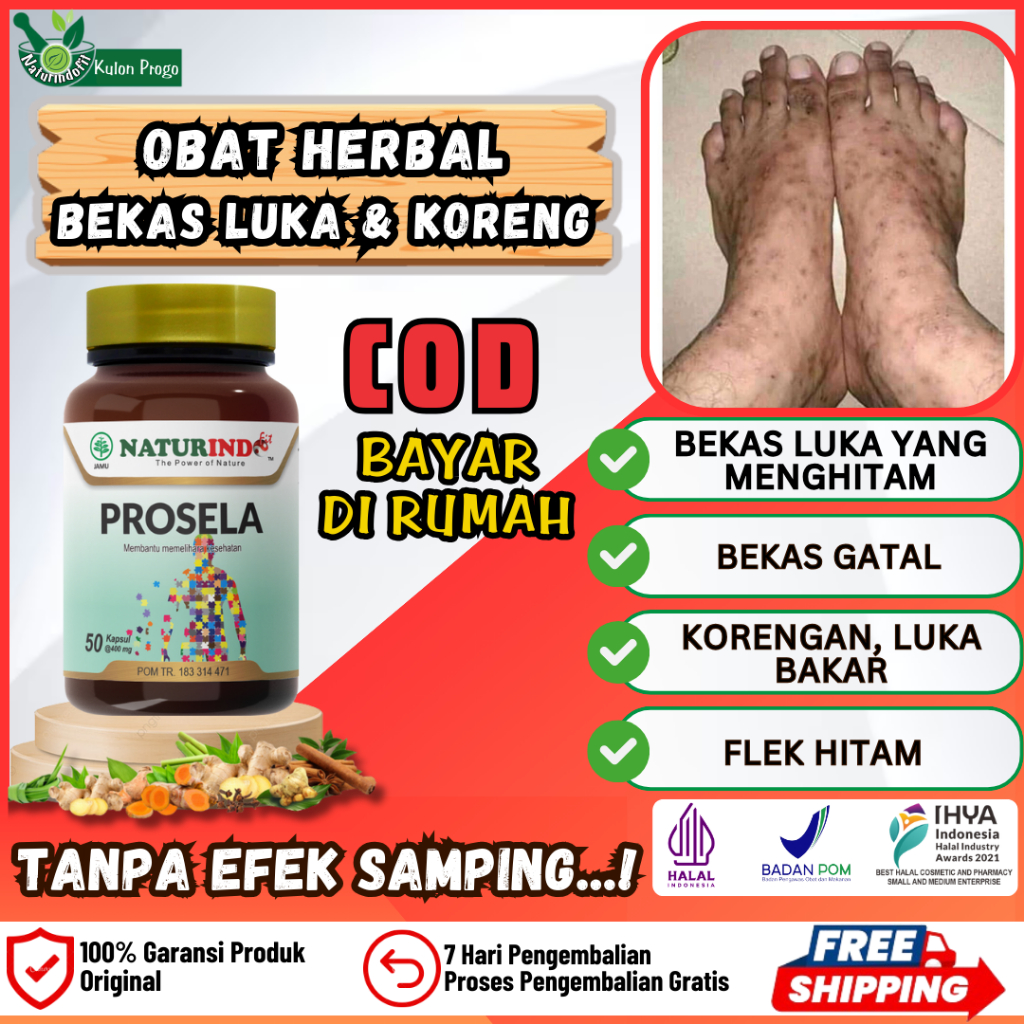 Prosela Obat Koreng Penghilang Bekas Luka Bakar Menghitam Korengan Gatal Flek Hitam Paling Ampuh