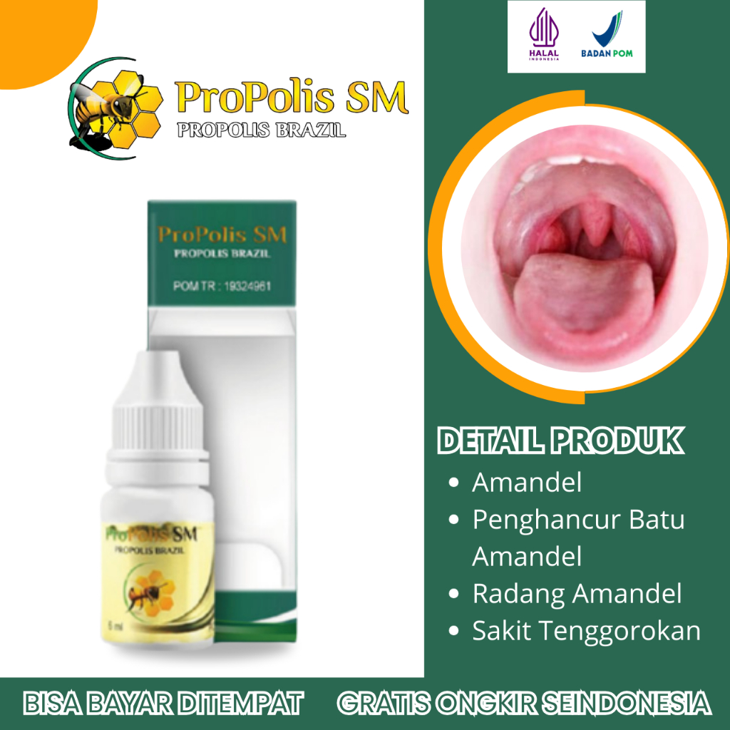 Obat Amandel, Obat Amandel Bengkak, Obat Tenggorokan Amandel, Obat Radang Amandel, Obat Amandel Kron