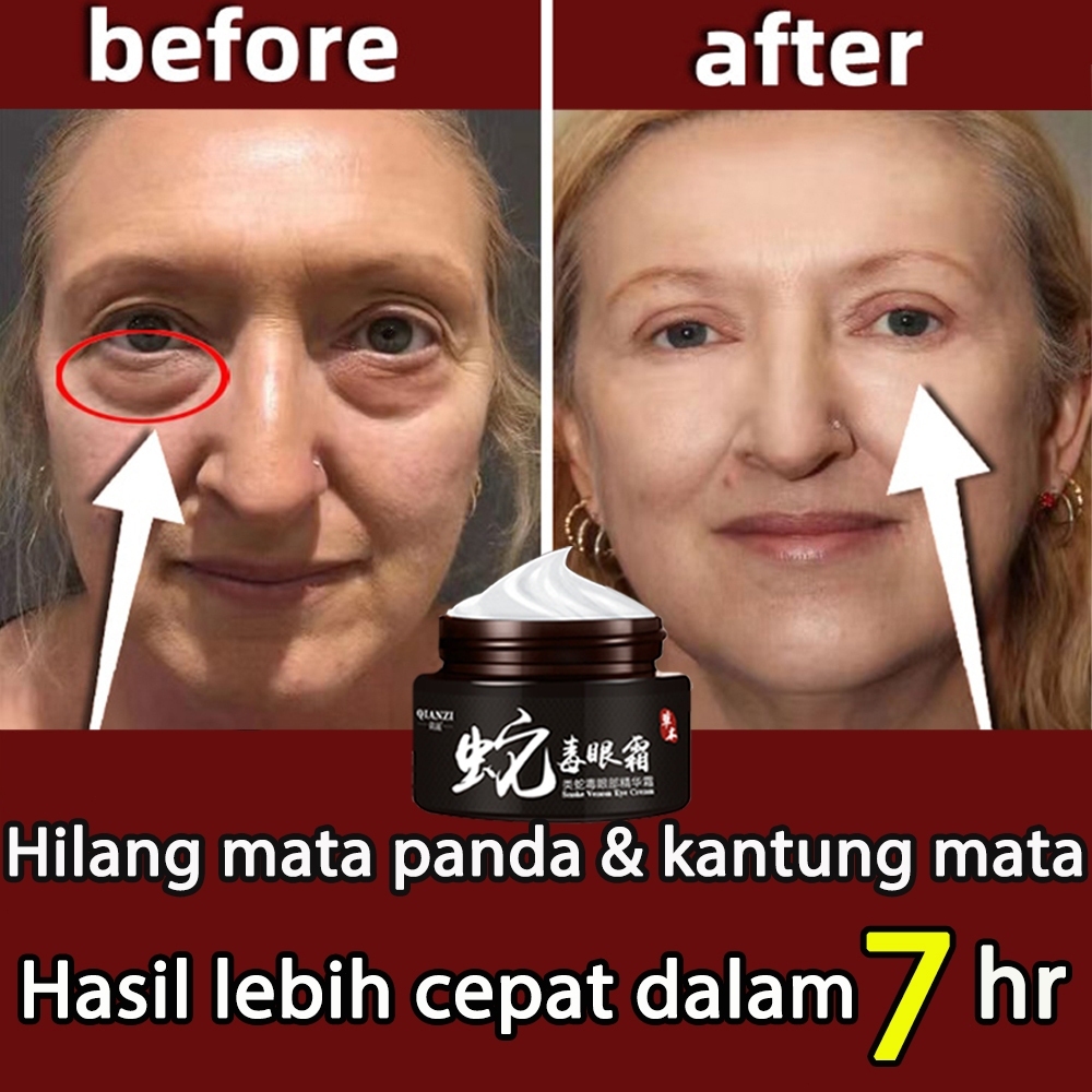 QIANGZI Krim mata racun ular/Krim Pemutih Kantung/Krim Kantung Mata/Mata Panda Keriput/Krim Mata Ant