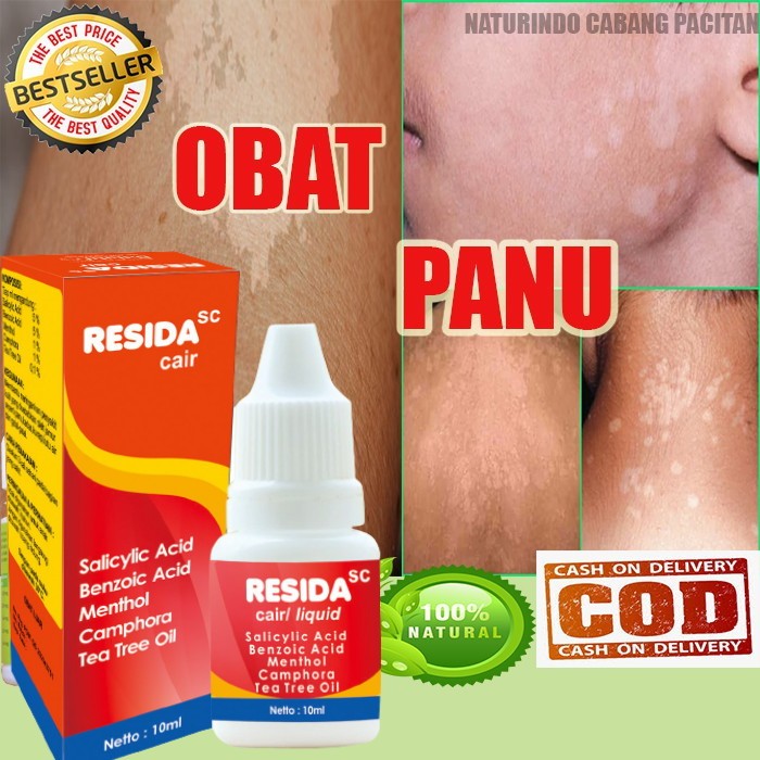 Penghilang Panu Resida Cair Obat Panu Pengganti Kalpanax Lebih Ampuh Aman Bpom /RESIDA CAIR / SEBAGA