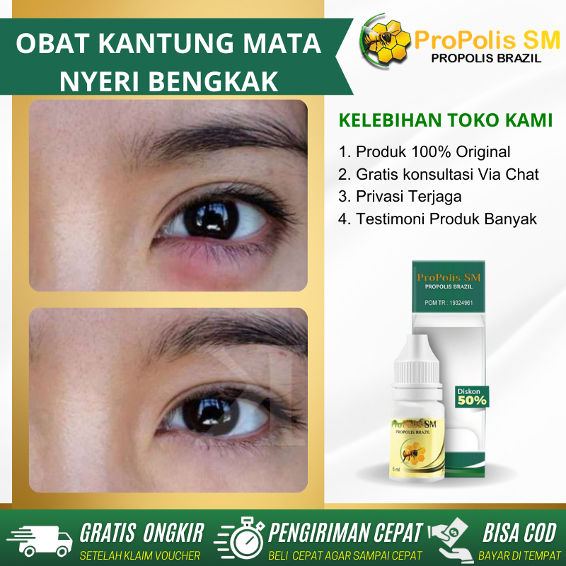 OBAT KELOPAK MATA BENGKAK DAN SAKIT SAAT BERKEDIP OBAT KELOPAK MATA BENGKAK DAN GATAL PADA ANAK OBAT