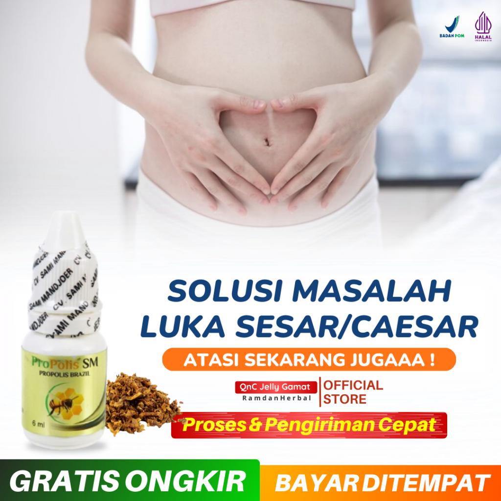 Luka Sesar Bernanah Lama Kering Infeksi Luka Caesar Nyeri Bengkak Gatal Berair Penghilang Bekas Luka