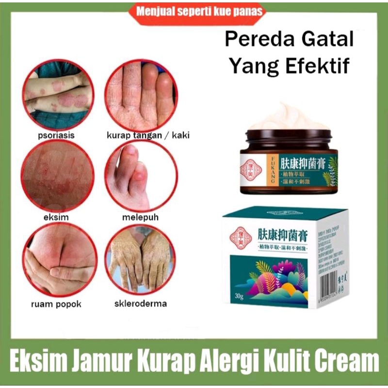 SALEP GATAL PALING AMPUH OBAT SALEP KULIT JAMUR DERMATITIS PSORIASIS EKSIM JAMUR KURAP DAN  ALERGI K