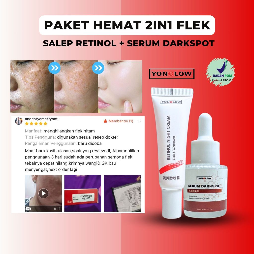 Paket 2in1 Serum Darkspot Salep Flek Cina BPOM Retinol Night Cream Yonglow Skincare Salep Penghilang