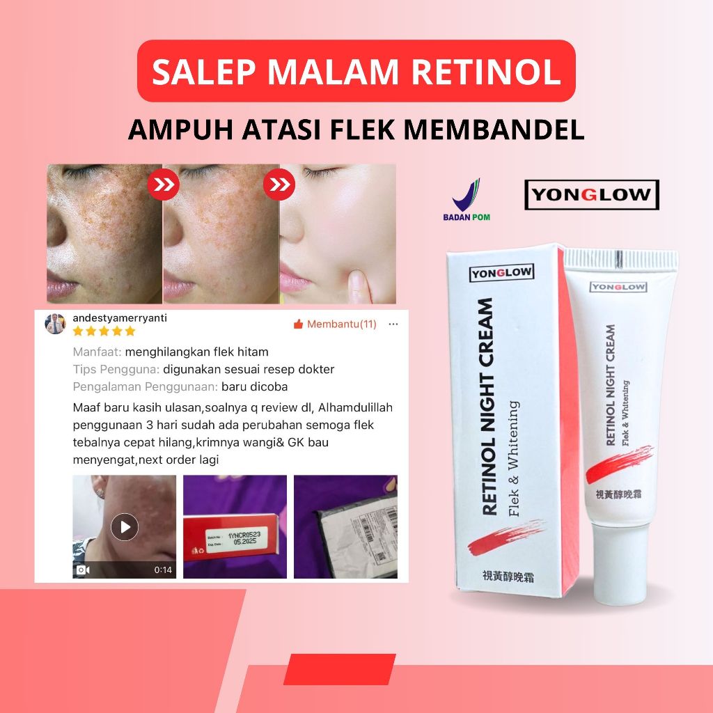 Salep Cina BPOM Yonglow Skincare Salep Retinol Flek Hitam Melasma Bintik Hitam Bekas Jerawat Ampuh