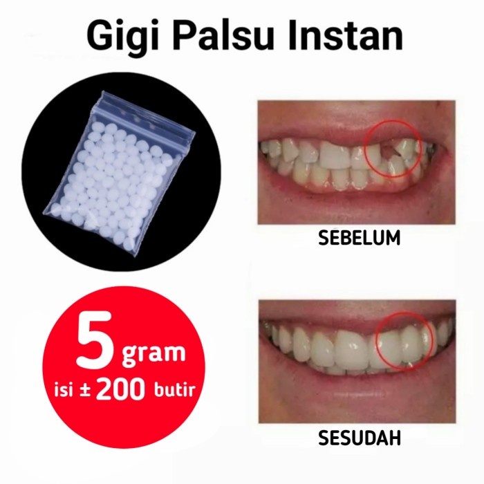 RATUDELI GIGI PALSU SEMENTARA 200 BUTIR / PENAMBAL GIGI PATAH RENGGANG TEMPORARY TOOTH TEMPTOOTH GIN