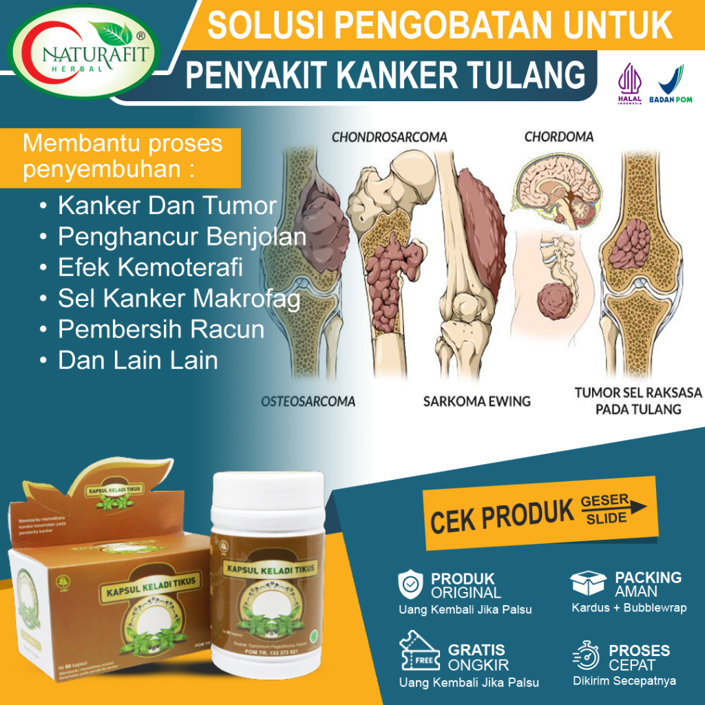 Obat kanker Tulang Paling Ampuh Tumor tulang Tanpa Operasi Sendi Tulang Bengkak Kanker Tulang Sumsum