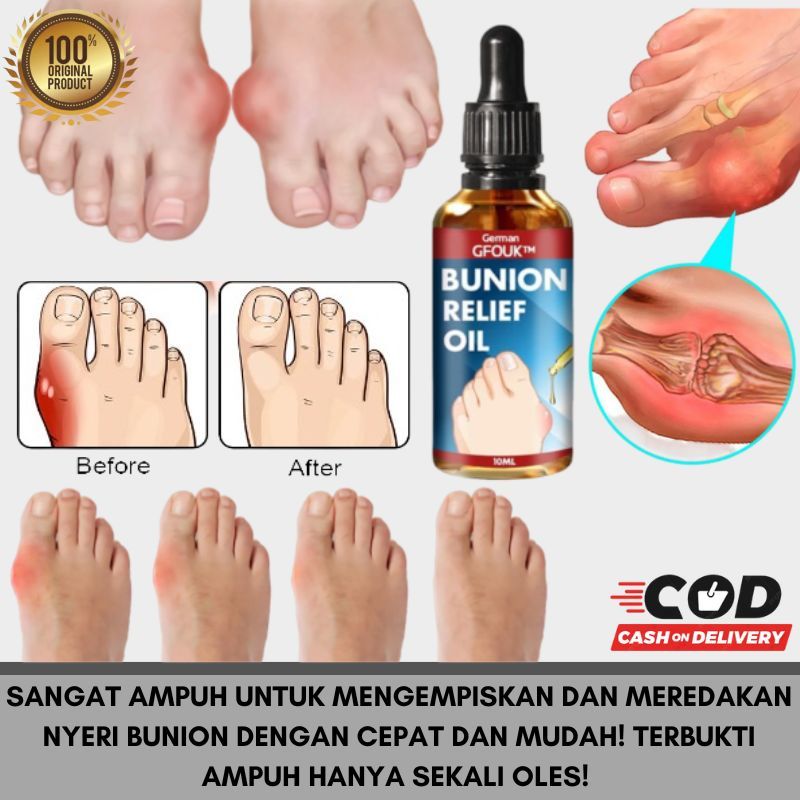 Bunion Pain Relief Oil Minyak Pijat Pengempis Penghilang Bunion