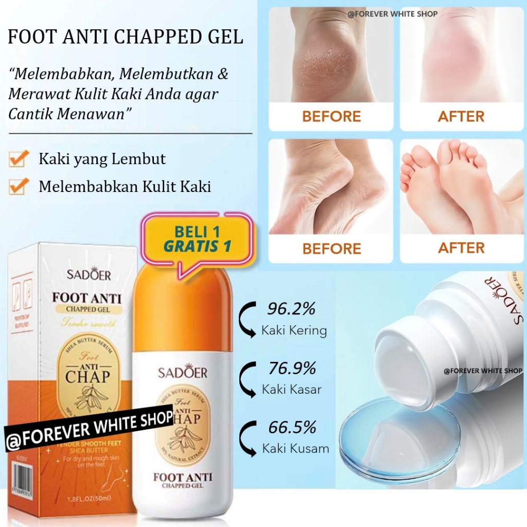 Beli 1 GRATIS 1  Sadoer Foot Mask Chapped Gel Obat Kaki Pecah Dan Kering Foot Cream Kaki FWS / Krim 