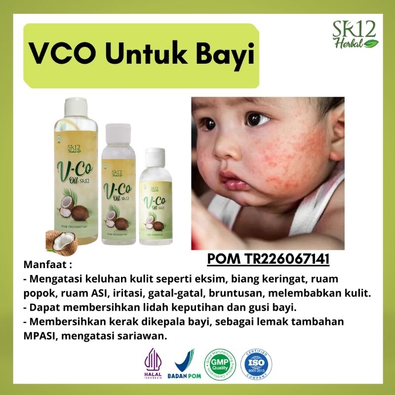 Bisa COD / VCO SR12 Minyak Kelapa Untuk Eksim Bayi / Perawatan Bayi Newborn / VCO For Baby