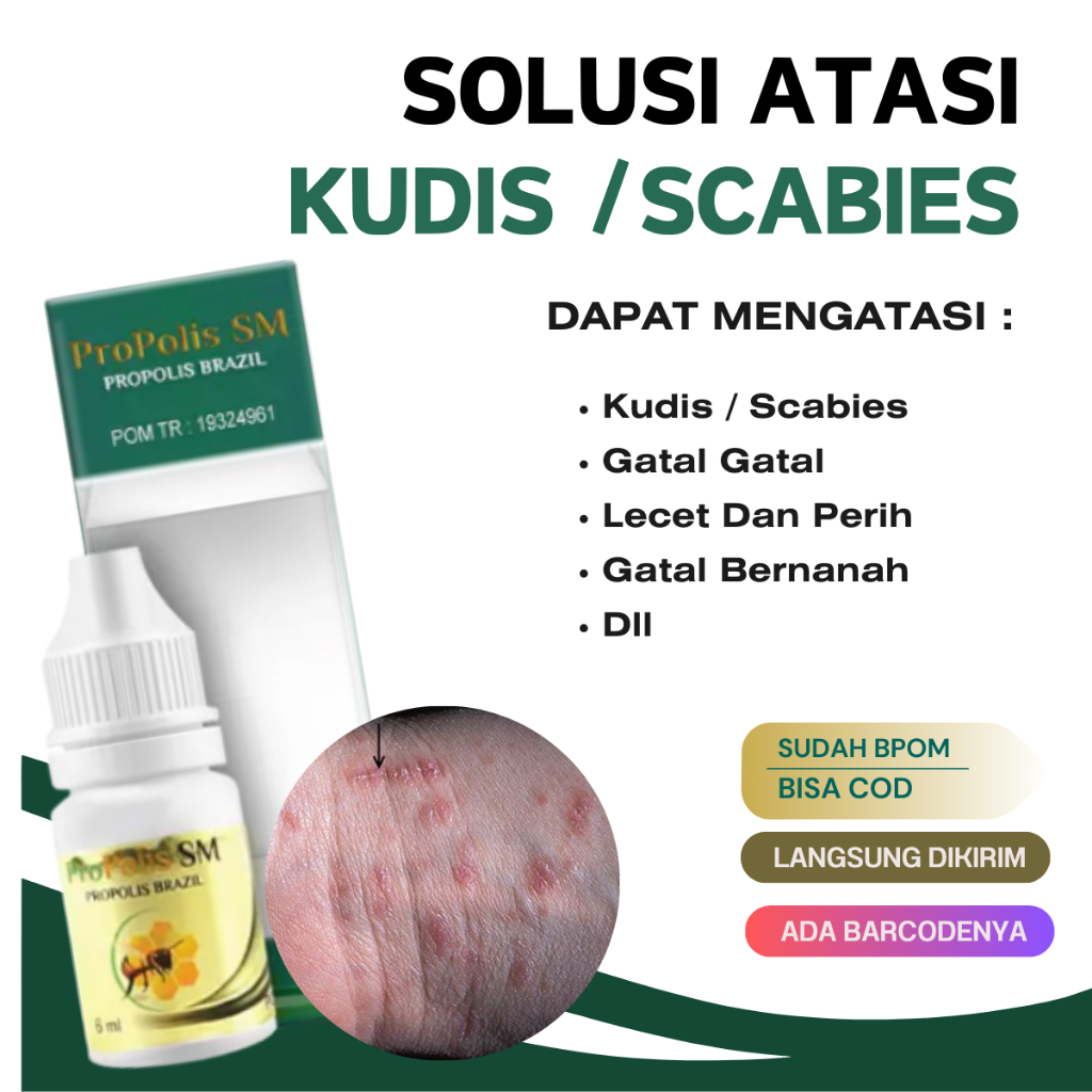 Propolis SM Herbal Obat Kudis Scabies Manusia