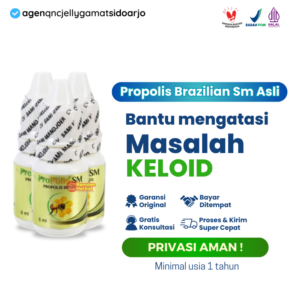 Obat Penghilang Keloid, Penumpas Bekas Luka Menonjol, Obat Keloid - Propolis SM Obat Oles Keloid