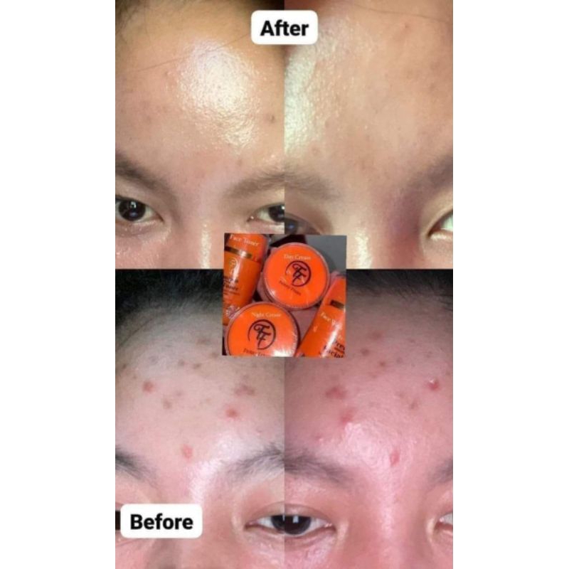 FF Premium fenny frans