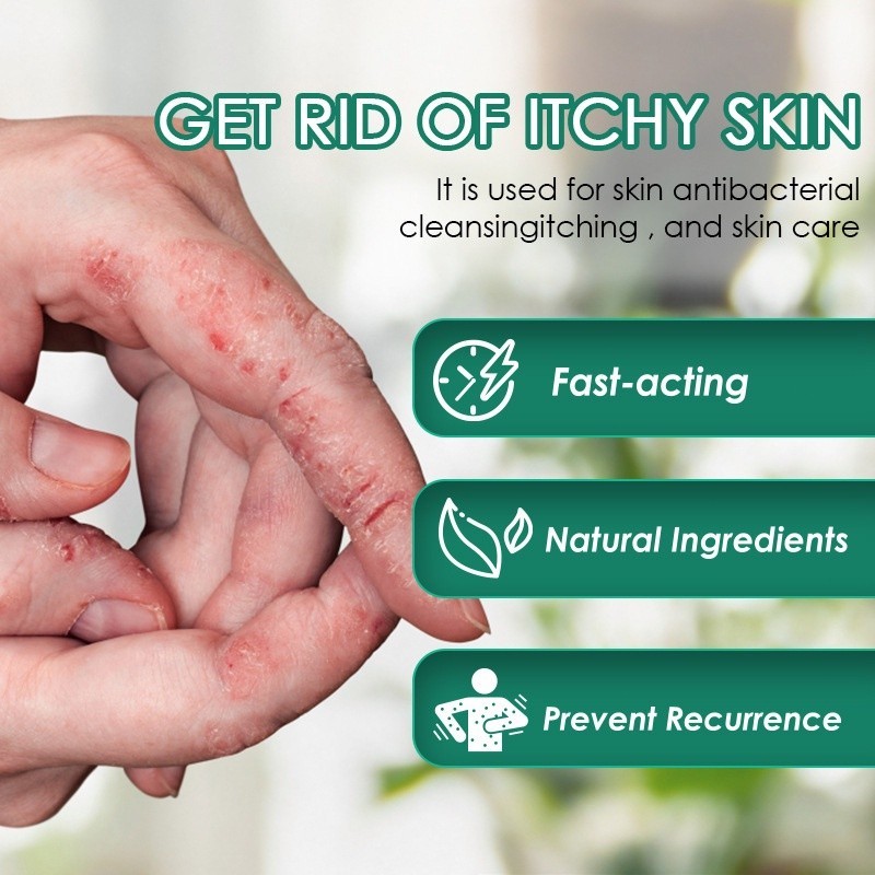 salep gatal paling ampuh Untuk orang yang tua dan anak Untuk seluruh tubuh Salep Fukang Cina ORIGINA