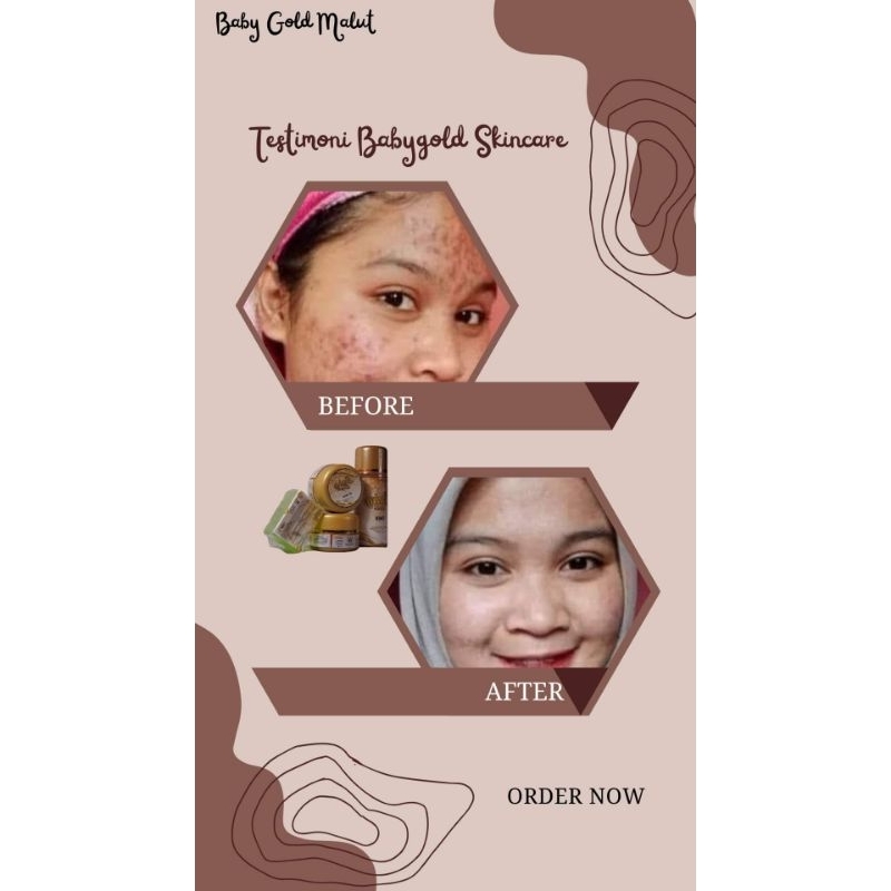 COD-ECERAN CREAM BABY GOLD PAKET ACNE/ ECERAN BABY GOLD PAKET ACNE ORIGINAL