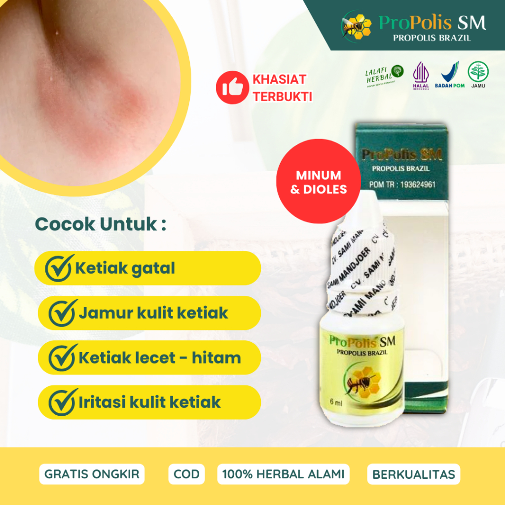 Obat Gatal Ketiak Iritasi Kulit Ketiak Berjamur Lecet dan Hitam Propolis SM Brazil