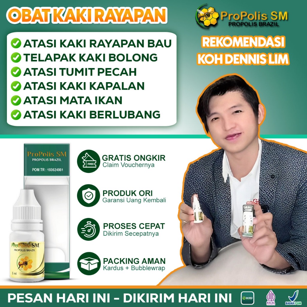 Obat Kaki Rayapan, Kaki Pecah Dan Kering, Kaki Rayapan Dan Bau, Kaki Pecah Pecah, Tetes Oles Kaki Ra