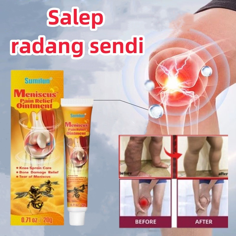 Meniscus pain relief ointment Obat Sakit Lutut Salep asam urat mengatasi nyeri lutut sendi Bunion pa