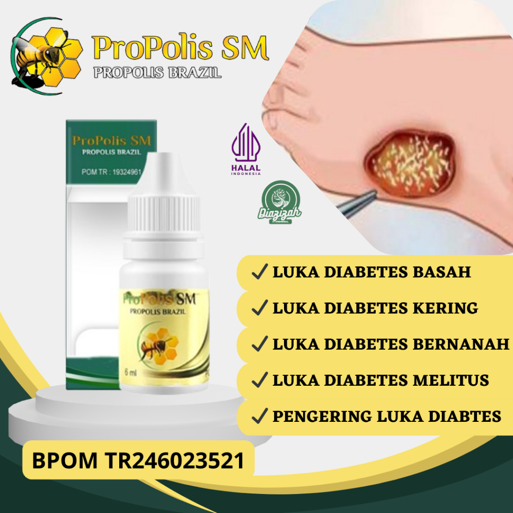 Obat Luka Diabetes, Obat Luka Diabetes Kering, Obat Luka Diabetes Basah, Obat Luka Diabetes Bernanah