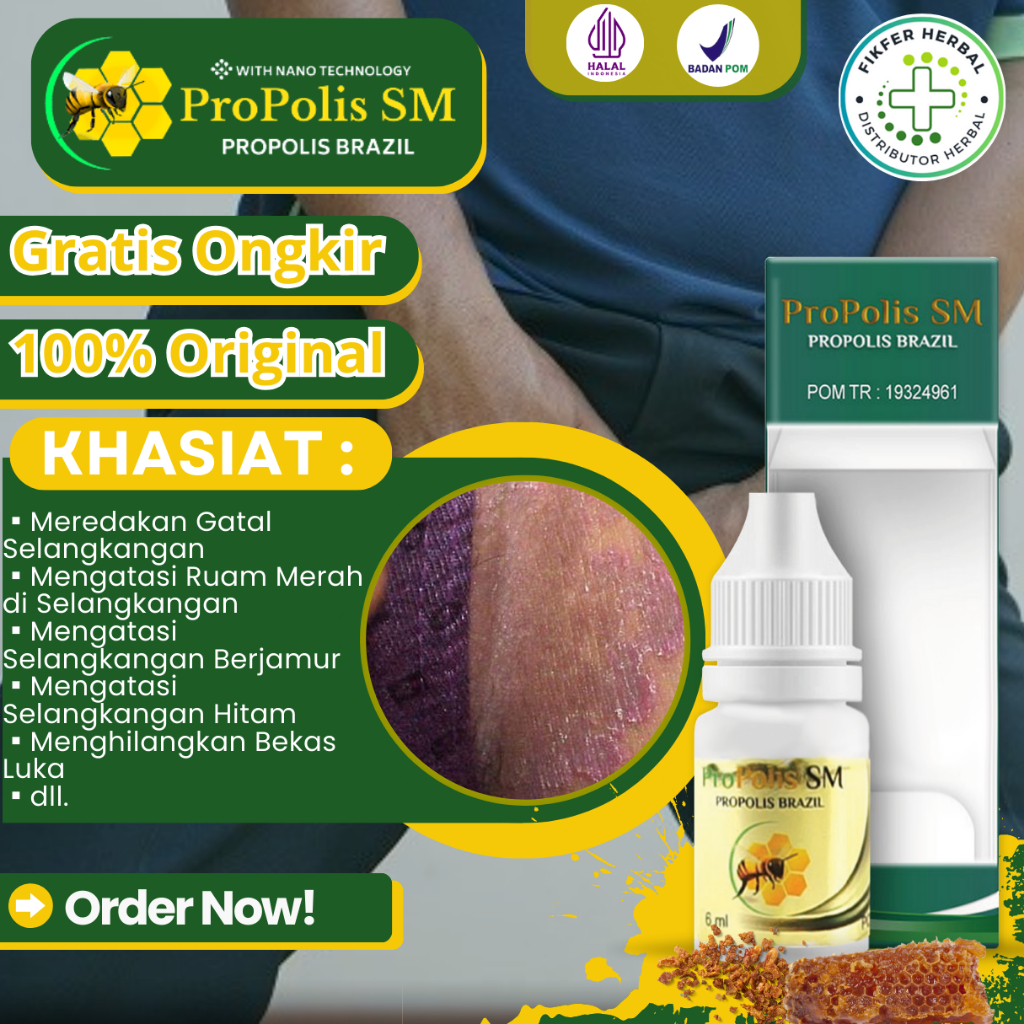 [BISA COD] Obat Gatal Selangkangan, Obat Ruam Merah di Selangkangan, Selangkangan Berjamur, Bintik -