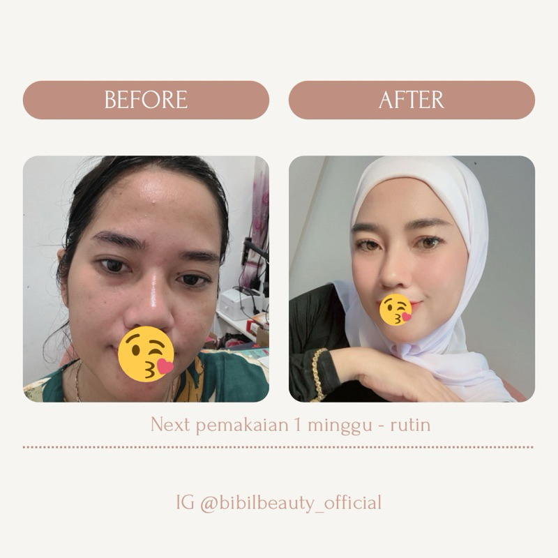 paket skincare brightening glow - bibil beauty ‼️free spray miss v