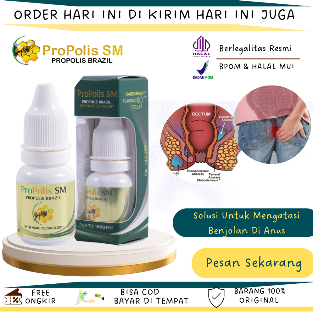 Obat Fistula Ani Obat Nyeri Anus Obat Nyeri Dubur Obat Anus Bengkak Obat Bisul Deket Anus Obat Anus 