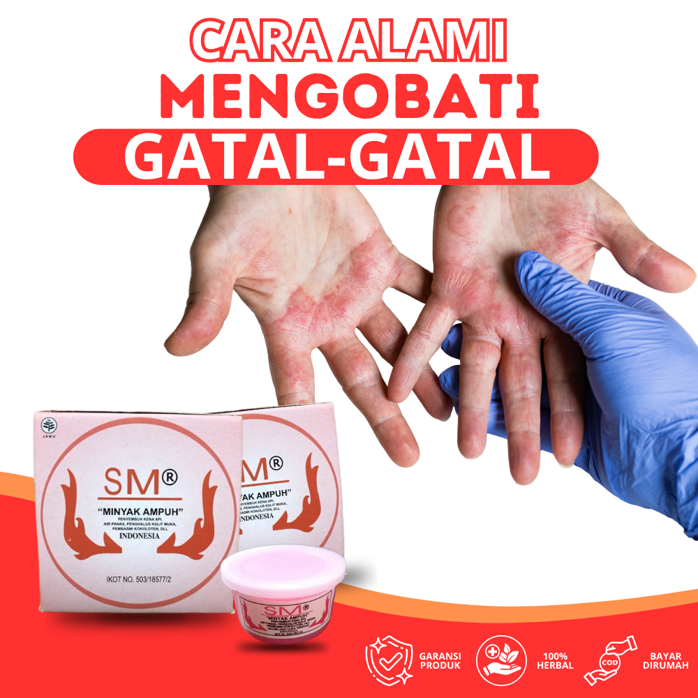 Terlaris minyak ampuh sm | SM minyak ampuh | Krim Cream Saleb Wasir dan Salep Ambeyen Obat Ambeien