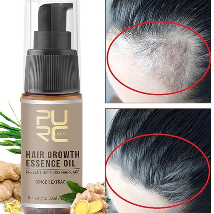 MEGA SALE PURC Obat Anti Rontok Penumbuh Rambut Original Pria Wanita Pertumbuhan Rambut Esensi Pertu