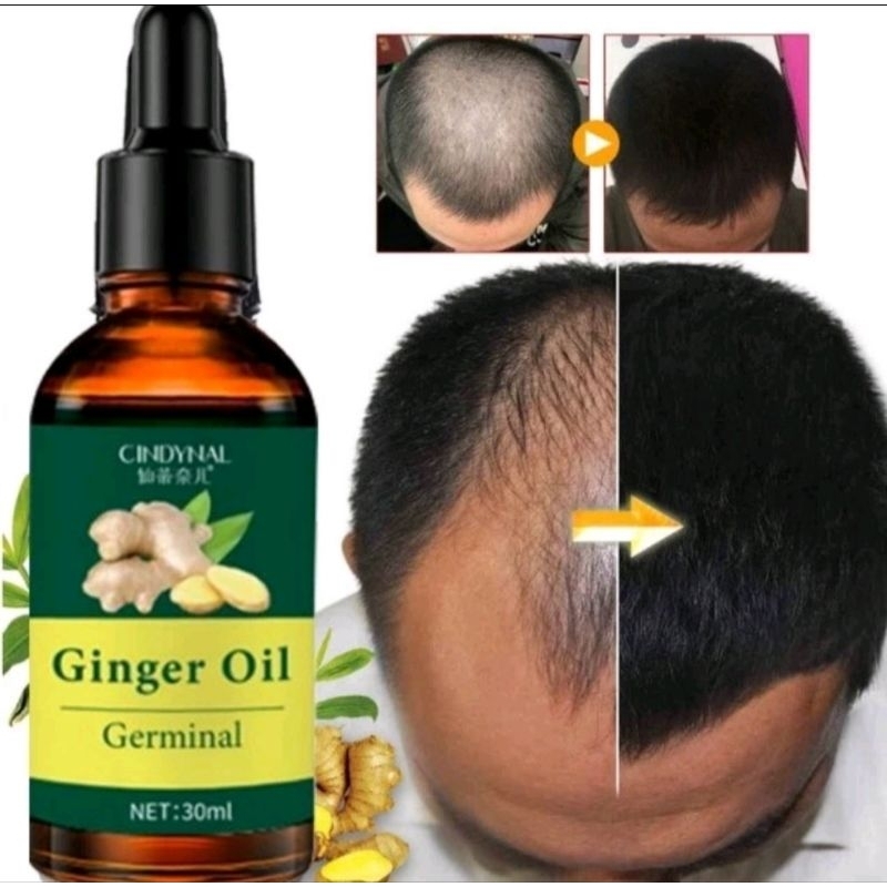 Ginger Oil Germinal 30ml
