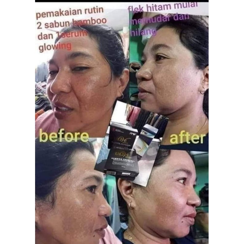 (BISA COD) paket flek hitam sabun Bambo + glowing serum msi ORi