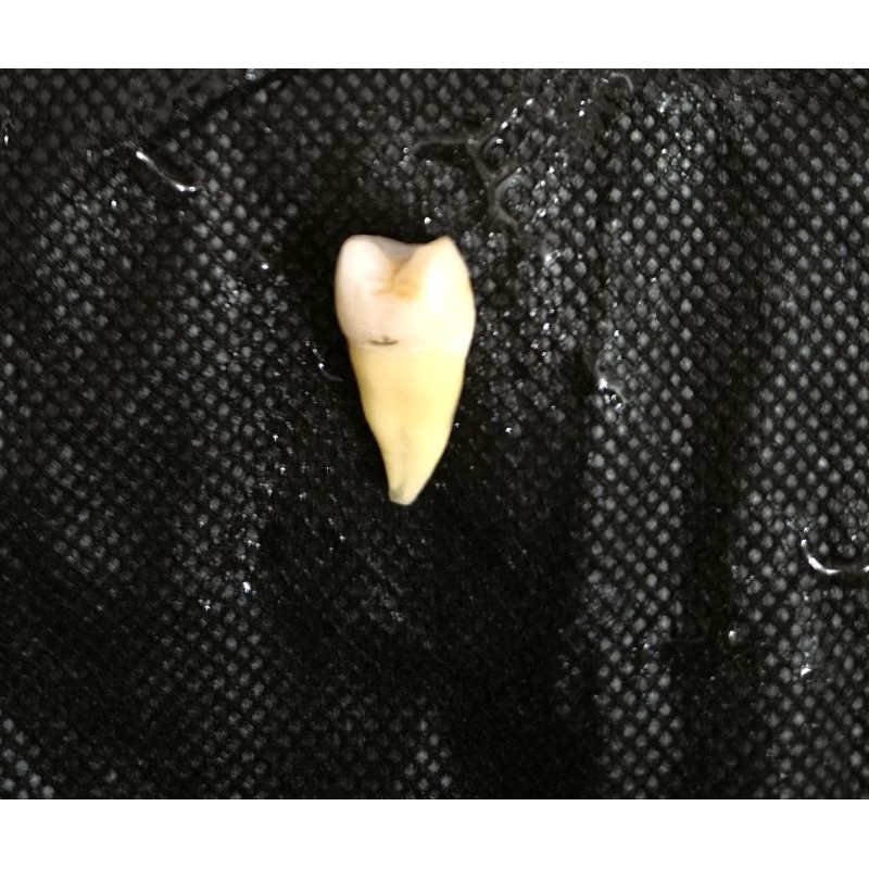 Gigi/ unsur praktikum kedokteran gigi, premolar atas