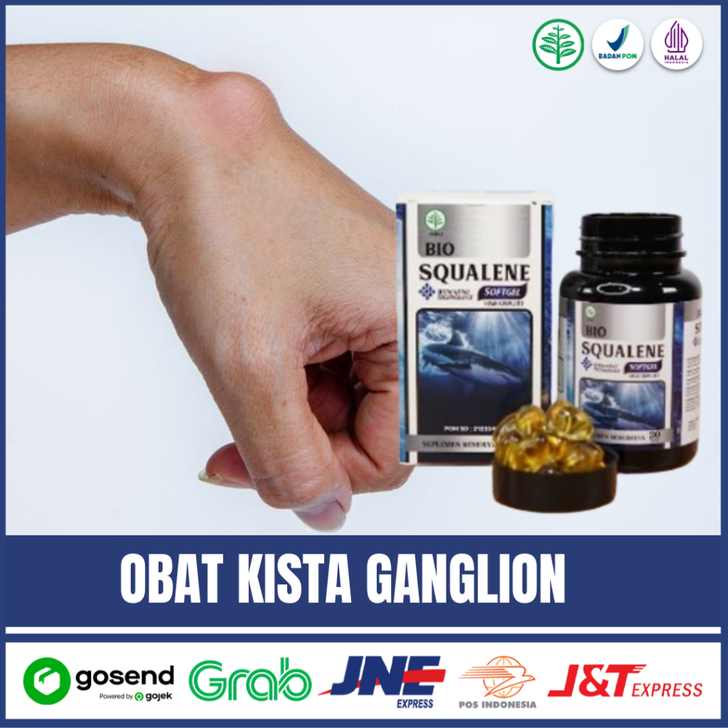 Obat Kista Ganglion,Benjolan Ganglion,Benjolan Di Tangan&Pergelangan Tangan,Bio Squalene Di Surabaya