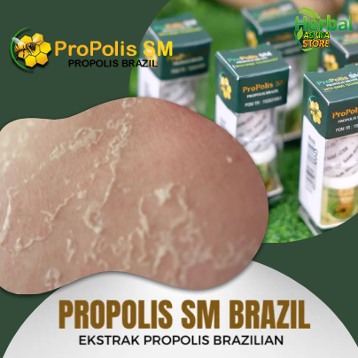 Obat Penghilang Selangkangan Gatal Hingga Mengelupas, Herbal Oles Antijamur Gatal - Gatel Pembersih 