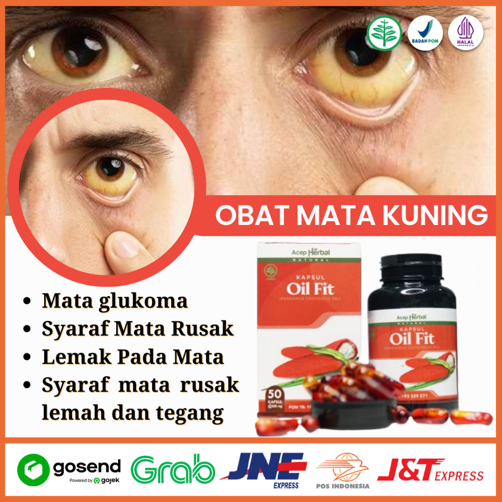 Obat Mata Kuning, Penjernih Mata, Pemutih Mata Kuning, Obat Mata Merah Iritasi dan Berlemak