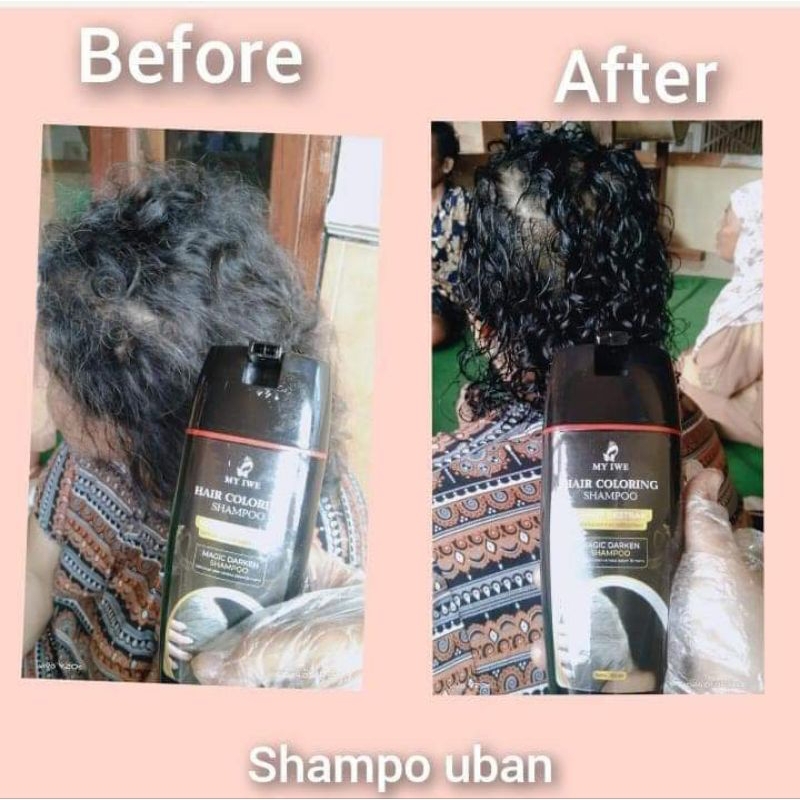 Sampo Anti Uban My Iwe