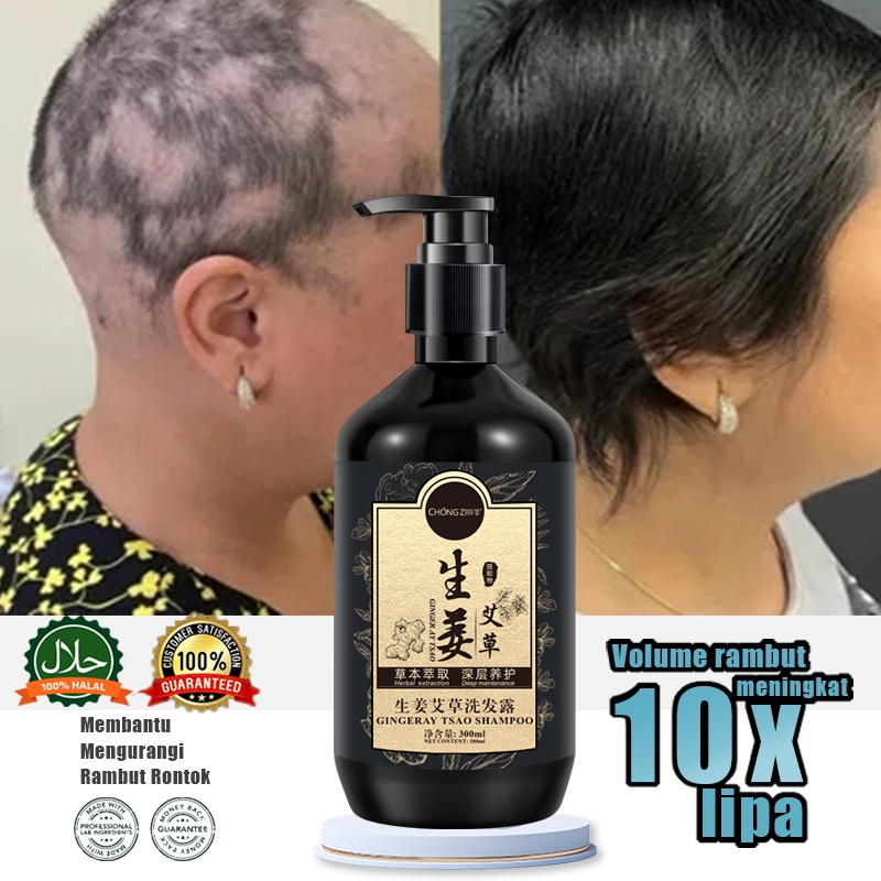 Shampo penumbuh rambut cepat Obat Penumbuh Rambut Botak Penumbuh Rambut Botak obat penumbuh rambut