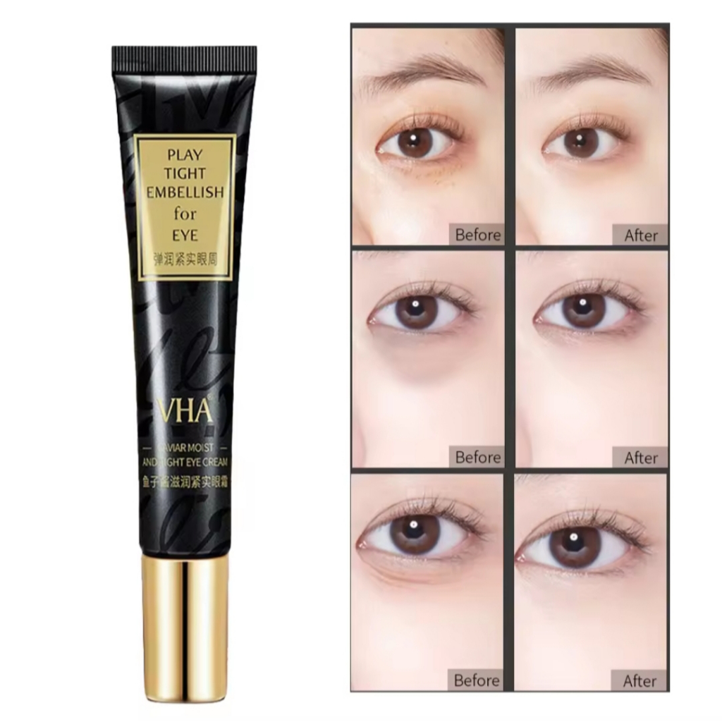 ORI 100% VHA Caviar Moist And Tight Eye Cream / Wonder Eye Cream Anti-Aging Wrinkle Dark Circle Mois