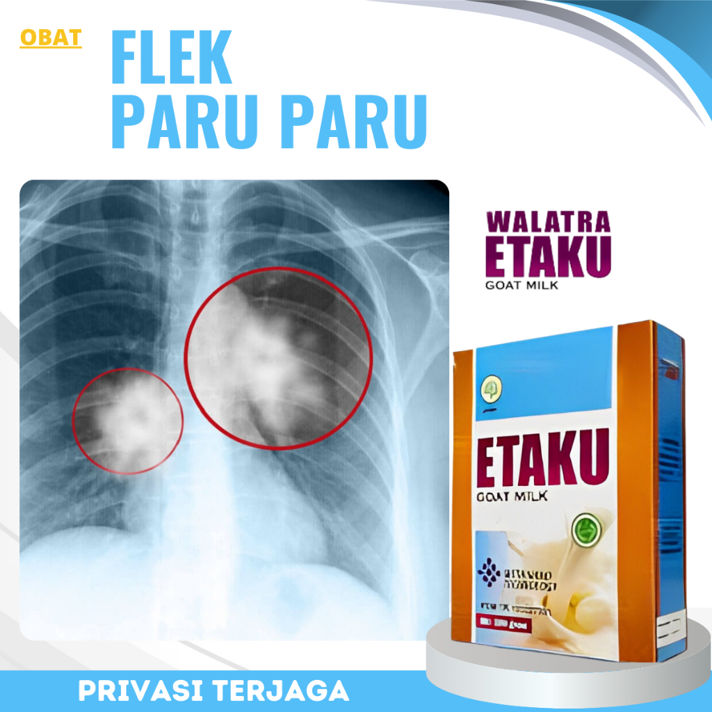 

Obat Flek Paru Paru, Susu Pembersih Paru Paru kotor / Paru Paru Perokok, Obat Batuk Berdarah, Obat Asma Sesak Nafas Nyeri, Bronkhitis TBC, Sakit Tenggorokan, ISPA, Susu Pelengkap Nutrisi Anak Hingga Lansia, Susu Pembersih Flek Paru Paru - Susu E