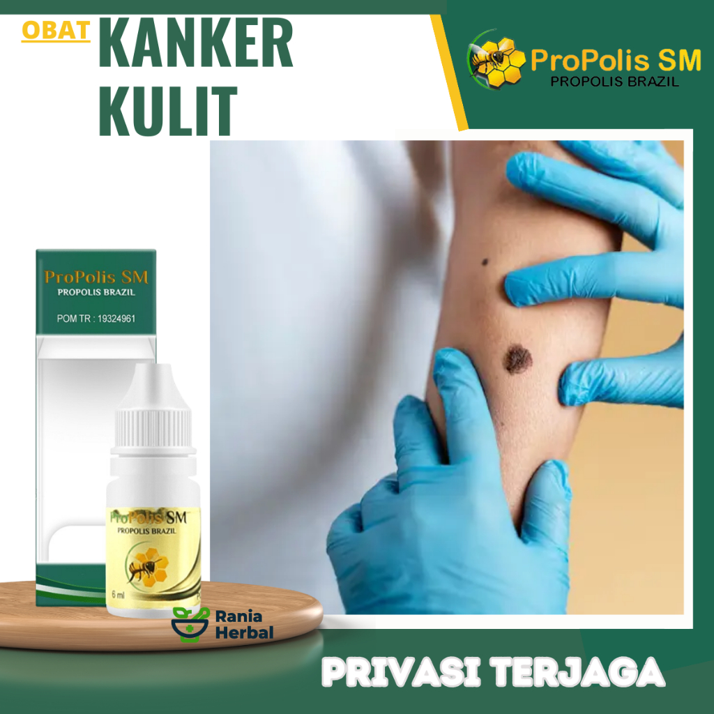Obat Kanker Kulit, Melanoma, Obat Kulit Berjamur, penghilang Bercak Di kulit, Penghilang Kanker Kuli