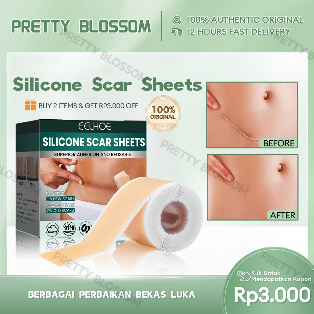 EELHOE Dermaline Silicone Keloid 1Roll Keloplast Silicone Keloid Plester Scar Tape Keloid Bekas Luka