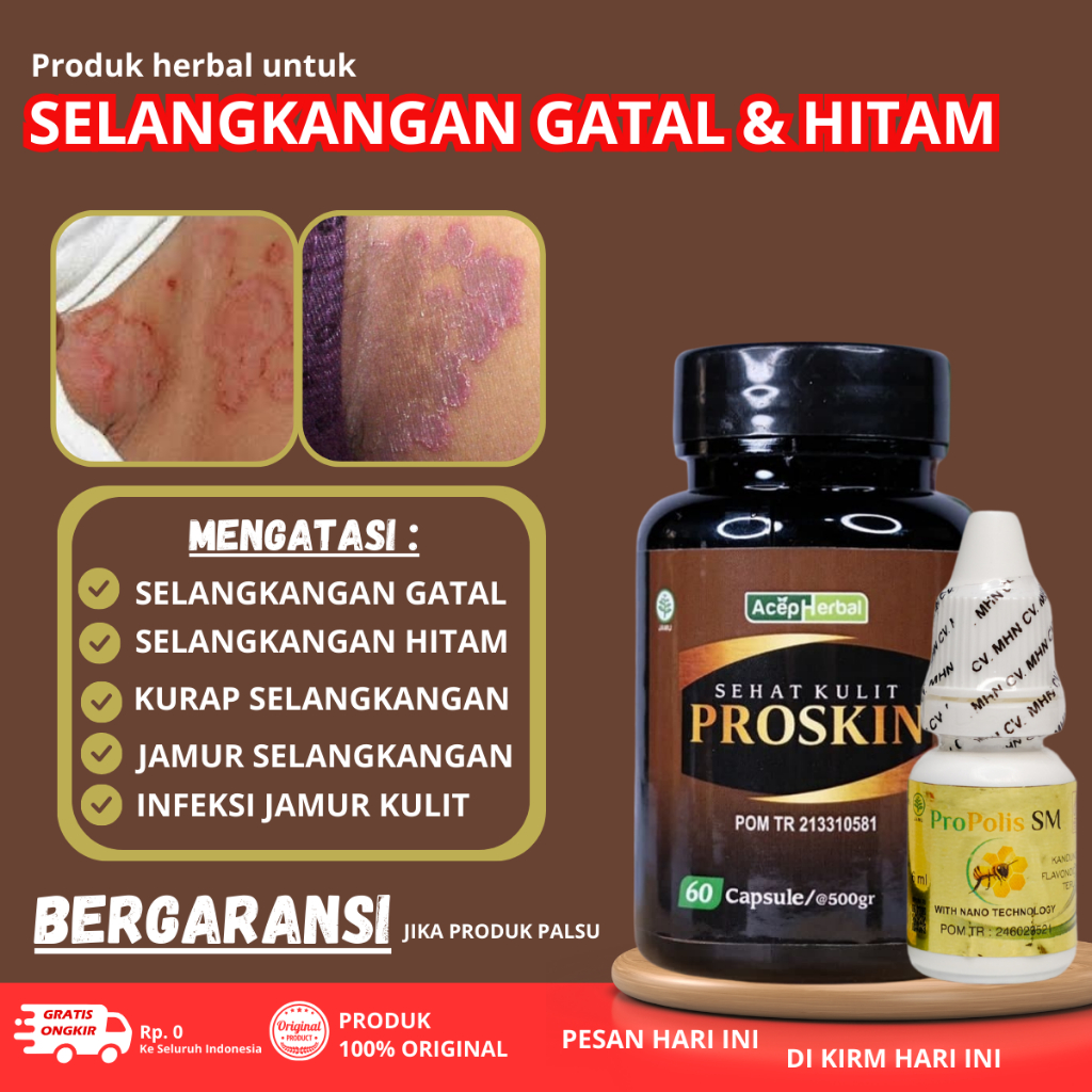 Salep Selangkangan akibat jamur - Salep Gatal Selangkangan - Salep Selangkangan gatal dan lecet - Ob