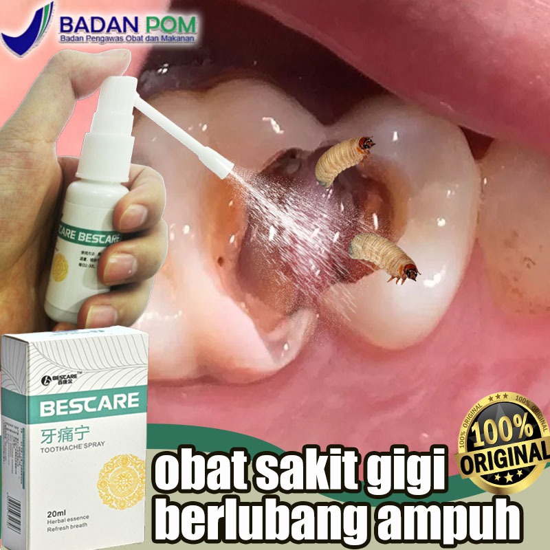 Obat sakit gigi berlubang ampuh Obat sakit gigi paling ampuh obat sakit gigi ampuh Obat gigi