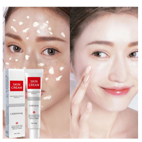 【COD】 Remove Dark Spots Anti Freckle Cream Niacinamide Fade Pigmentation Melasma Brighten Cream