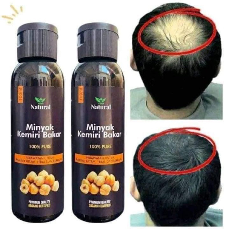 Minyak kemiri bakar natural/ MKB NATURAL