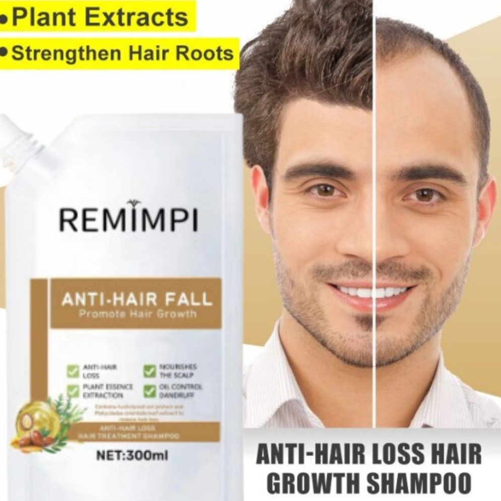 Remimpi Official  Shampoo Remimpi Penumbuh Rambut Botak dan Tipis k U1D8