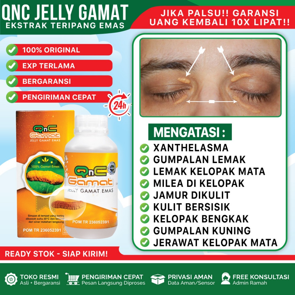 Obat Xanthelasma, Obat Penghilang Xanthelasma, Obat Bercak Kuning Kelopak Mata - QnC Jelly Gamat
